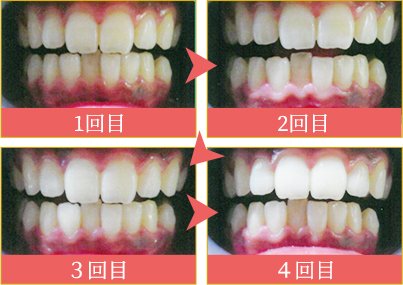 ビフォーアフター2
